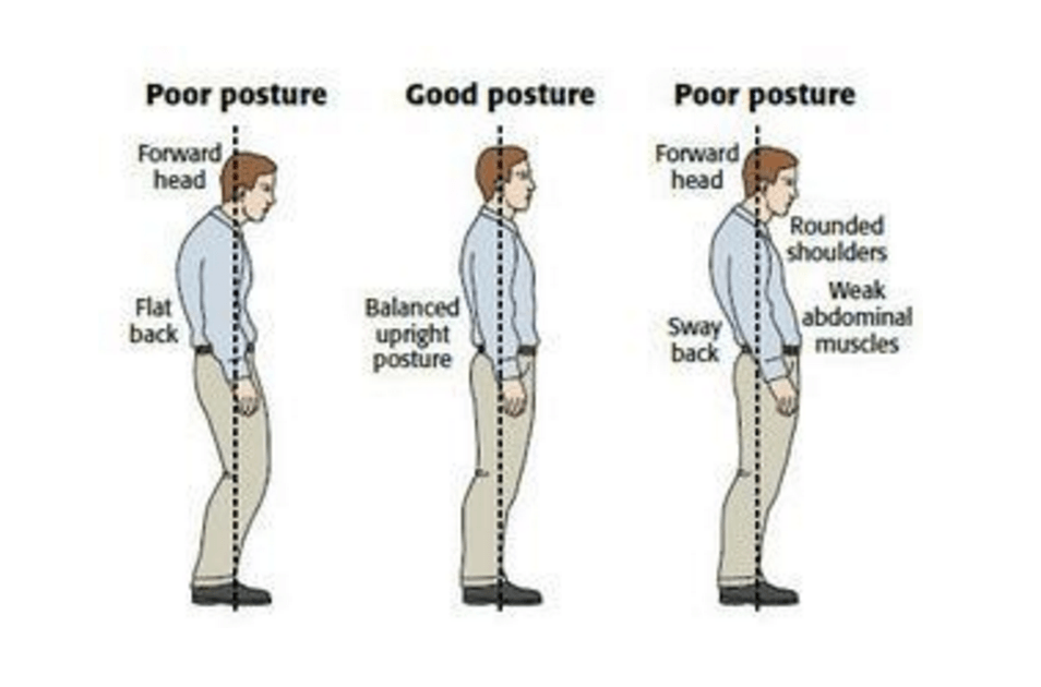 图片来源：http：//www.thephysiocompany.com/blog/stop-slouching-postural-dysfunction-symptoms-causes-and-treatment-of-bad-posture