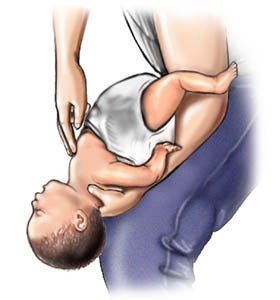 帮助窒息婴儿的步骤（4-5）来源：www.webmd.com