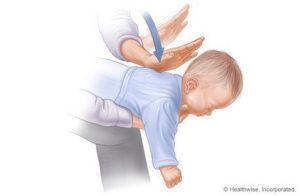 帮助窒息婴儿的步骤（1-3）来源：www.webmd.com