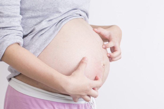瘙痒性毛囊炎是妊娠期皮肤瘙痒的原因