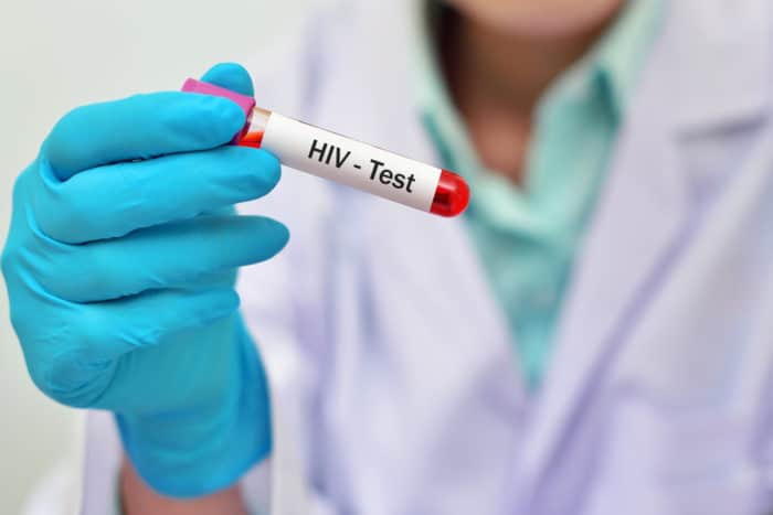 HIV血液检查