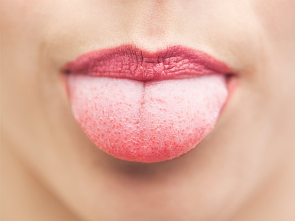 舌头的颜色表示疾病